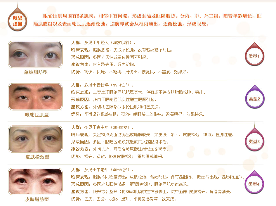 眼袋類型